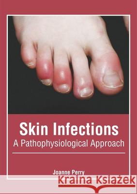 Skin Infections: A Pathophysiological Approach Joanne Perry 9781632426185