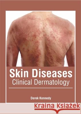 Skin Diseases: Clinical Dermatology Derek Kennedy 9781632426208