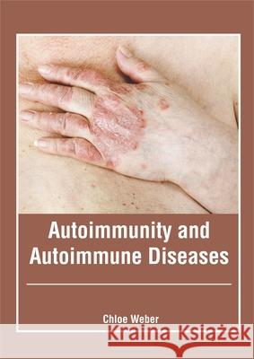 Autoimmunity and Autoimmune Diseases Chloe Weber 9781632426871 Foster Academics