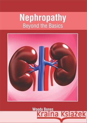 Nephropathy: Beyond the Basics Woody Bones 9781632427076 Foster Academics