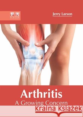 Arthritis: A Growing Concern Jerry Larson 9781632427649 Foster Academics