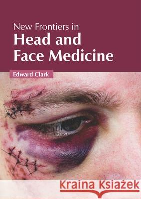 New Frontiers in Head and Face Medicine Edward Clark 9781632427717 Foster Academics