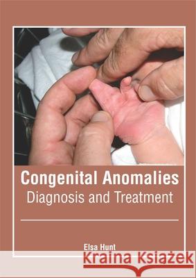 Congenital Anomalies: Diagnosis and Treatment Elsa Hunt 9781632427786 Foster Academics