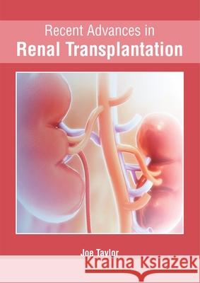 Recent Advances in Renal Transplantation Joe Taylor 9781632428110 Foster Academics