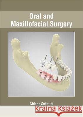 Oral and Maxillofacial Surgery Gideon Schmidt 9781632428196 Foster Academics