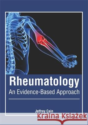 Rheumatology: An Evidence-Based Approach Jeffrey Cain 9781632428530 Foster Academics