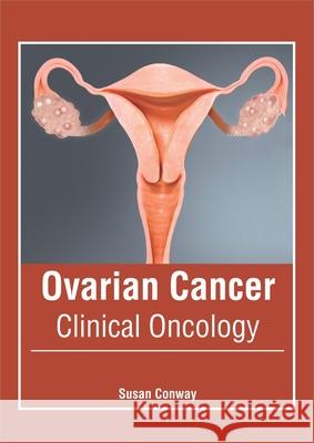 Ovarian Cancer: Clinical Oncology Susan Conway 9781632428622 Foster Academics