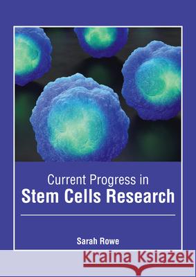 Current Progress in Stem Cells Research Sarah Rowe 9781632429025