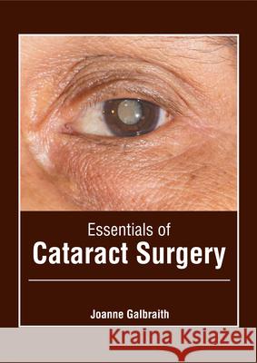 Essentials of Cataract Surgery Joanne Galbraith 9781632429421 