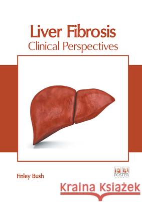Liver Fibrosis: Clinical Perspectives Finley Bush 9781632429568 Foster Academics
