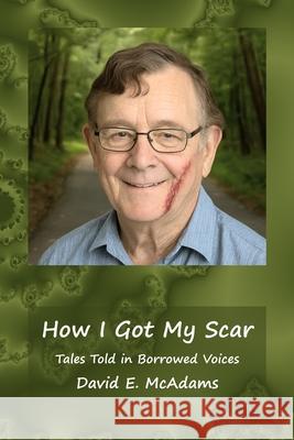 How I Got My Scar: Tales Told in Borrowed Voices David E. McAdams 9781632708069 Life Is a Story Problem LLC