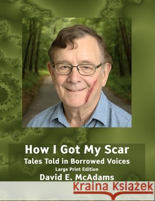 How I Got My Scar: Tales Told in Borrowed Voices David E. McAdams 9781632708083 Life Is a Story Problem LLC