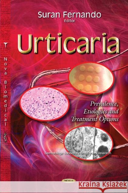 Urticaria: Prevalence, Etiologies & Treatment Options Suran Fernando 9781633210004