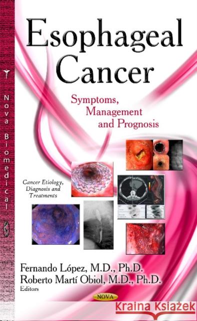 Esophageal Cancer: Symptoms, Management and Prognosis Fernando Lopez, Roberto Marti Obiol 9781633210820