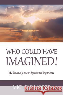 Who Could Have Imagined!: My Stevens-Johnson Syndrome Experience Michele Moore 9781633371897