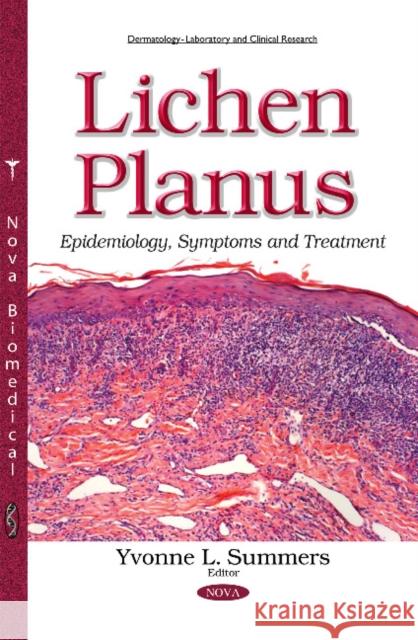 Lichen Planus: Epidemiology, Symptoms & Treatment Yvonne L Summers 9781634835411 Nova Science Publishers Inc