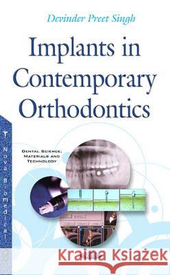 Implants in Contemporary Orthodontics Dr Devinder Preet 9781634843027 Nova Science Publishers Inc