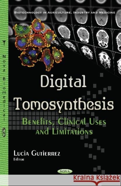 Digital Tomosynthesis: Benefits, Clinical Uses & Limitations Lucia Gutierrez 9781634851329 Nova Science Publishers Inc