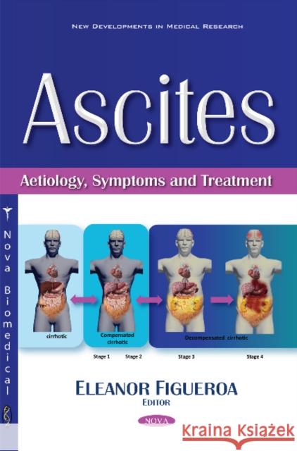 Ascites: Aetiology, Symptoms & Treatment Eleanor Figueroa 9781634854597