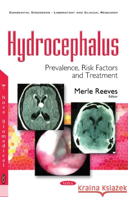 Hydrocephalus: Prevalence, Risk Factors & Treatment Merle Reeves 9781634855600 Nova Science Publishers Inc