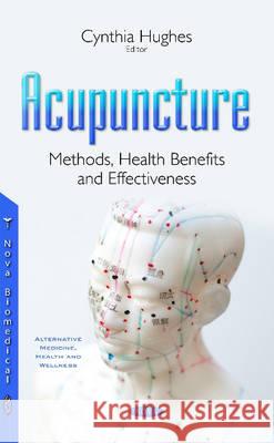 Acupuncture: Methods, Health Benefits & Effectiveness Cynthia Hughes 9781634855990 Nova Science Publishers Inc