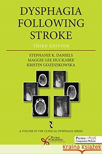 Dysphagia Following Stroke Stephanie K. Daniels Maggie Lee Huckabee Kristin Gozdzikowska 9781635500301 Plural Publishing Inc