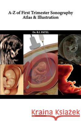 A-Z of First Trimester Sonography Atlas & Illustration B. I. Patel 9781636481968 Eliva Press