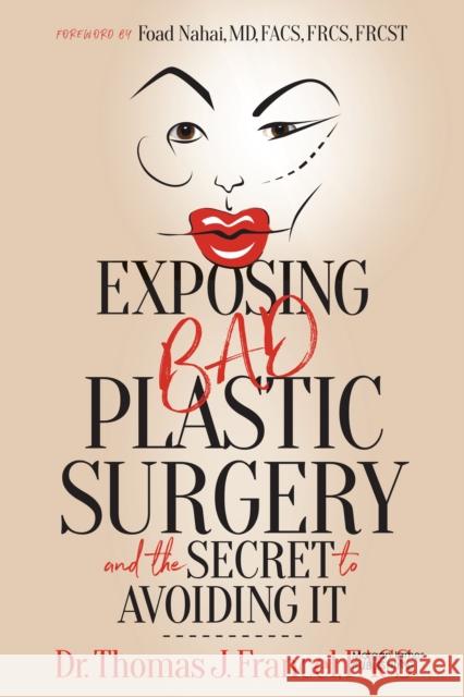 Exposing Bad Plastic Surgery: and the Secret to Avoiding It Dr. Thomas J. Francel 9781636984346 Morgan James Publishing llc