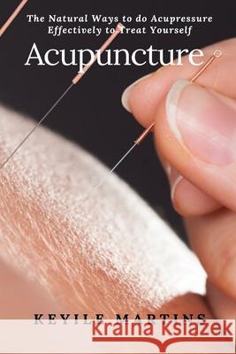 Acupuncture Martins Keyile Martins 9781637501757
