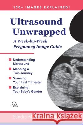 Ultrasound Unwrapped: A Week-by-Week Pregnancy Image Guide Sandra M. Minc 9781638219330