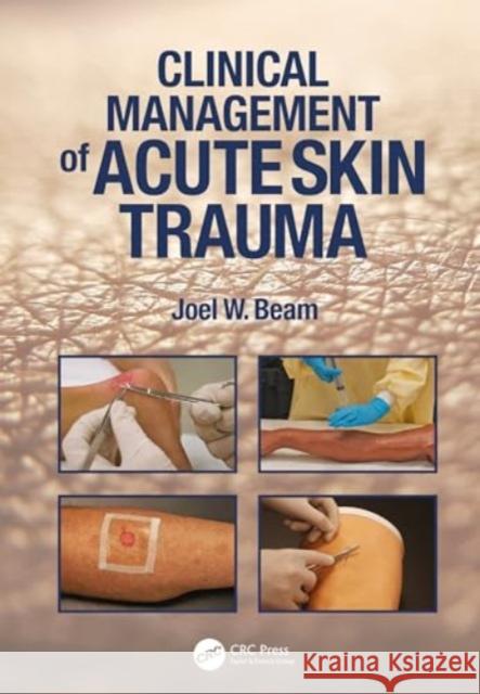 Clinical Management of Acute Skin Trauma Joel W. Beam 9781638220664 SLACK  Incorporated