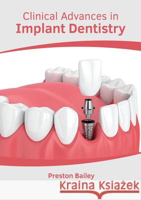 Clinical Advances in Implant Dentistry Preston Bailey 9781639270514 American Medical Publishers