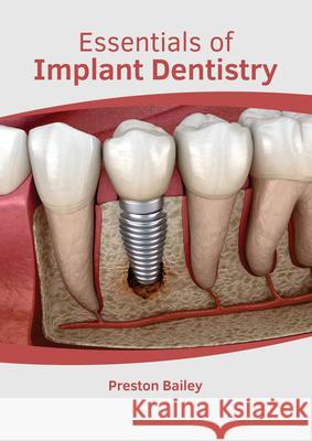 Essentials of Implant Dentistry Preston Bailey 9781639270538 American Medical Publishers