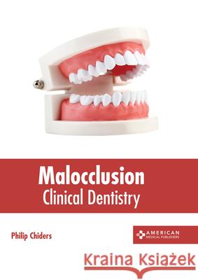 Malocclusion: Clinical Dentistry Philip Chiders 9781639270552 American Medical Publishers
