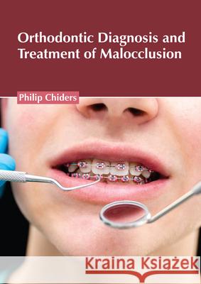 Orthodontic Diagnosis and Treatment of Malocclusion Philip Chiders 9781639270576 American Medical Publishers