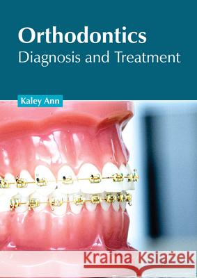 Orthodontics: Diagnosis and Treatment Kaley Ann 9781639270606 American Medical Publishers