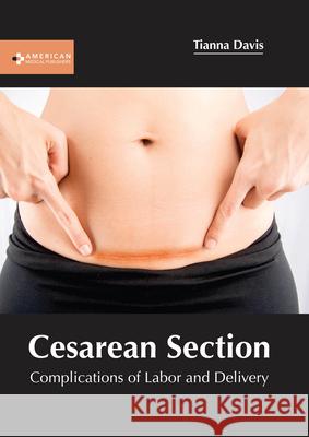 Cesarean Section: Complications of Labor and Delivery Tianna Davis 9781639271511 American Medical Publishers