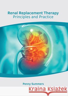 Renal Replacement Therapy: Principles and Practice Penny Summers 9781639272761 American Medical Publishers