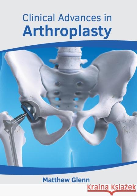 Clinical Advances in Arthroplasty Matthew Glenn 9781639273911 American Medical Publishers