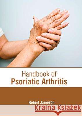 Handbook of Psoriatic Arthritis Robert Jameson 9781639273959