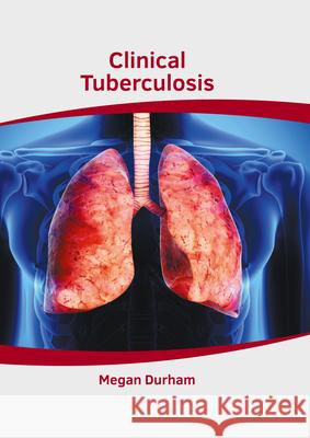 Clinical Tuberculosis Megan Durham 9781639274581 American Medical Publishers