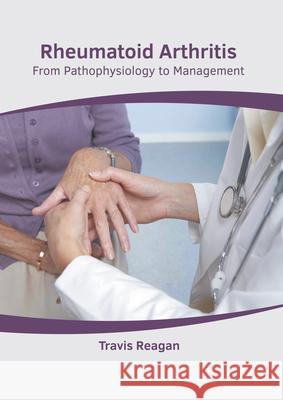 Rheumatoid Arthritis: From Pathophysiology to Management Travis Reagan 9781639274765 American Medical Publishers