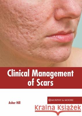 Clinical Management of Scars Asher Hill 9781639871148 Murphy & Moore Publishing
