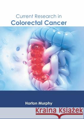 Current Research in Colorectal Cancer Horton Murphy 9781639871445 Murphy & Moore Publishing