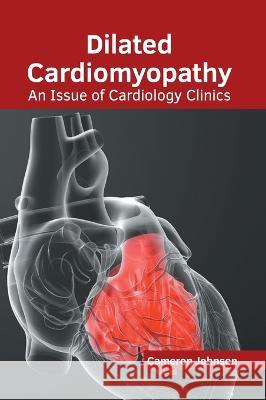Dilated Cardiomyopathy: An Issue of Cardiology Clinics Cameron Johnson 9781639871643 Murphy & Moore Publishing