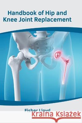 Handbook of Hip and Knee Joint Replacement Fisher Lloyd 9781639872831 Murphy & Moore Publishing