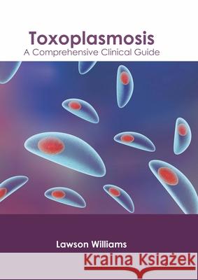 Toxoplasmosis: A Comprehensive Clinical Guide Lawson Williams 9781639875368 Murphy & Moore Publishing
