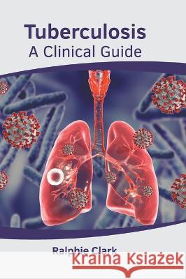 Tuberculosis: A Clinical Guide Ralphie Clark 9781639875429 Murphy & Moore Publishing