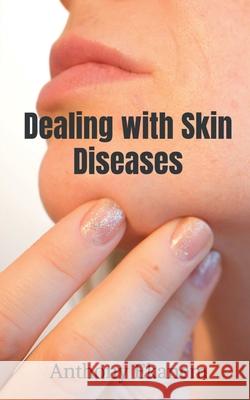 Dealing with Skin Diseases Anthony Ekanem 9781639977352 Notion Press