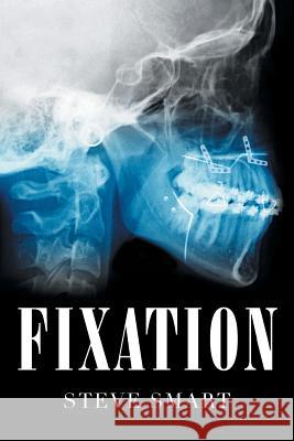 Fixation Steve Smart 9781640277779